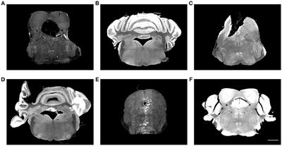 Mapping Histological Slice Sequences to the Allen Mouse Brain Atlas Without 3D Reconstruction